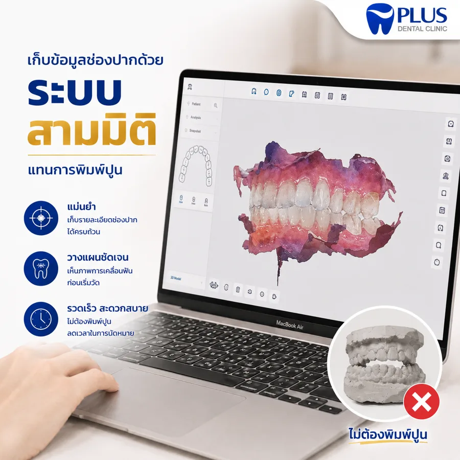 สแกนช่องปากด้วยระบบ 3 มิติ แทนการพิมพ์ปูน ที่ Plus Dental Clinic