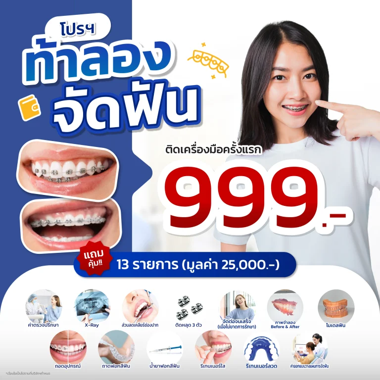 โปรจัดฟัน ติดเครื่องมือครั้งแรก 999 บาท — Plus Dental Clinic