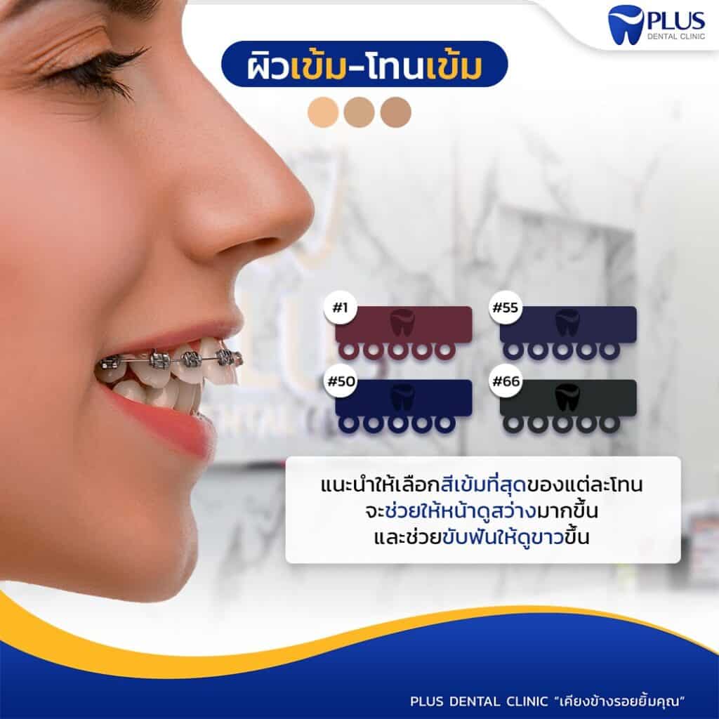 สุดปัง เลือกสียางจัดฟันยังไงให้เข้ากับสีผิว - คลินิกจัดฟัน Plus Dental  Clinic