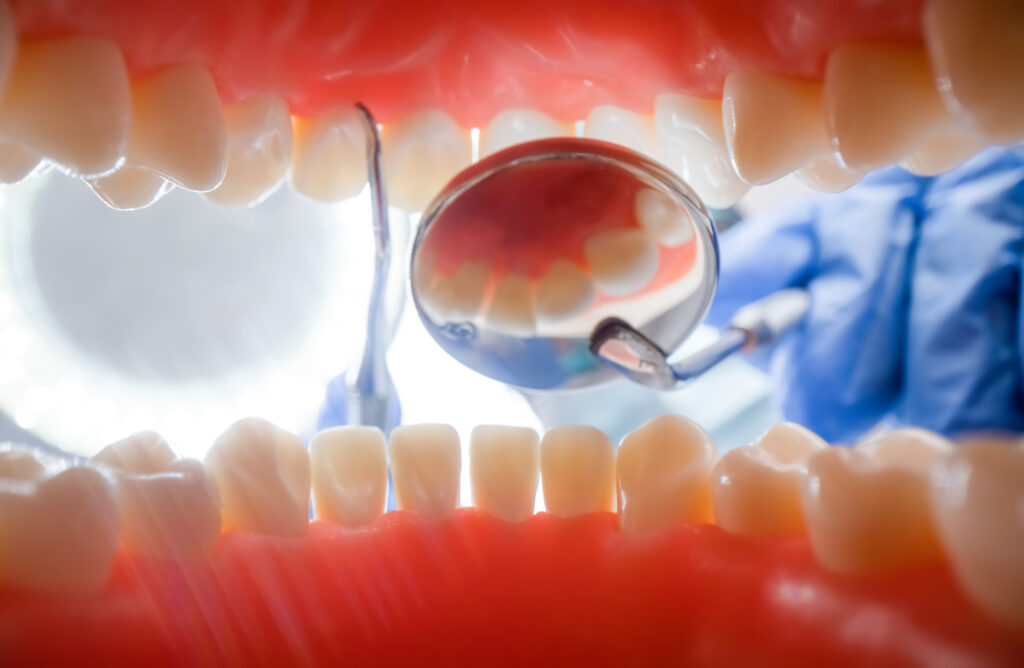 สีฟันเหลืองส่งผลต่อสุขภาพช่องปากหรือไม่?